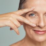 Aftercare Of Double Eyelid Surgery - How To Get The Best Result