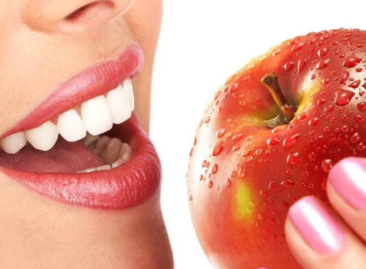 dental health and diet