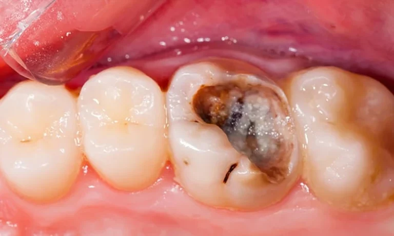6 Dental Symptoms You Should Never Brush Off