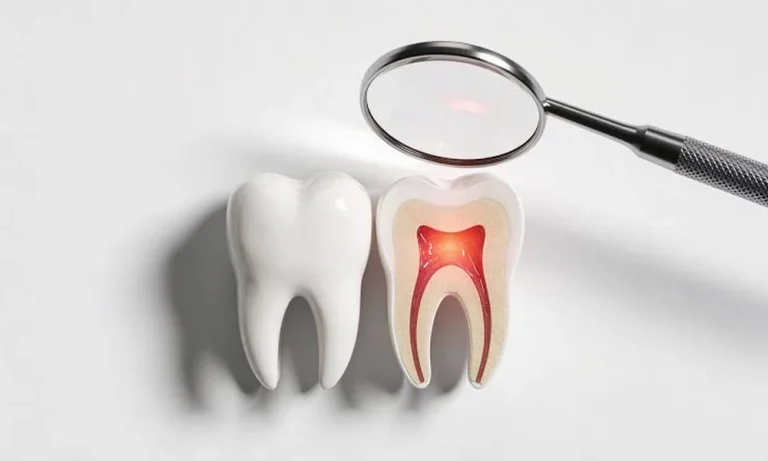 Root Canal Treatment Singapore: What to Expect